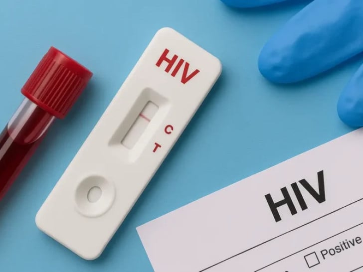 Svjetski dan borbe protiv HIV-a, besplatno testiranje širom Srpske